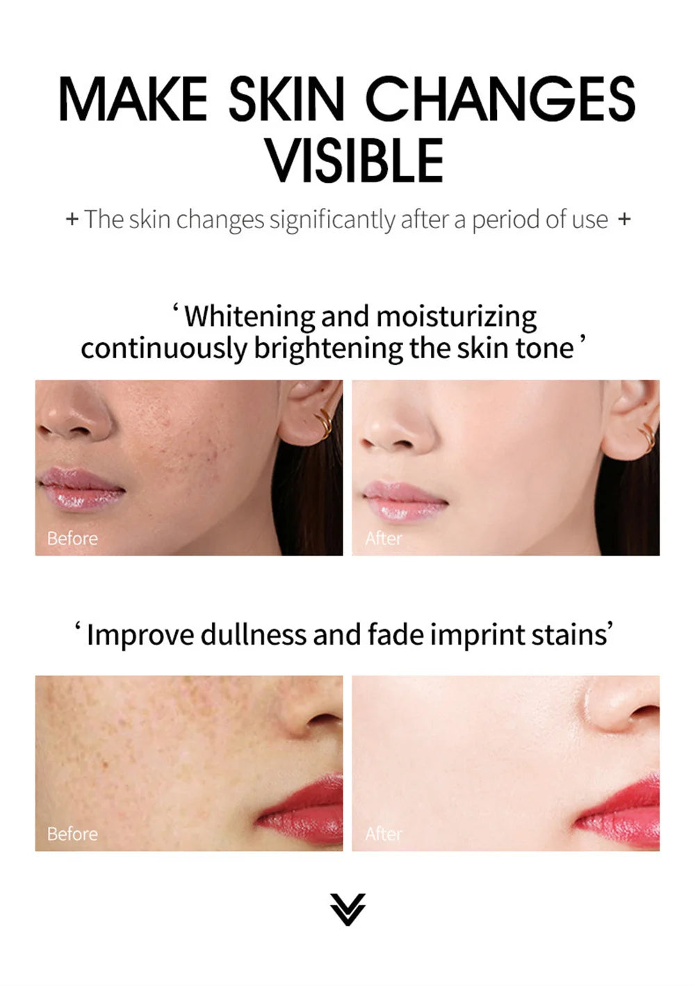 Spot-Removing Whitening Cream - Melasma & Dark Spot Treatment