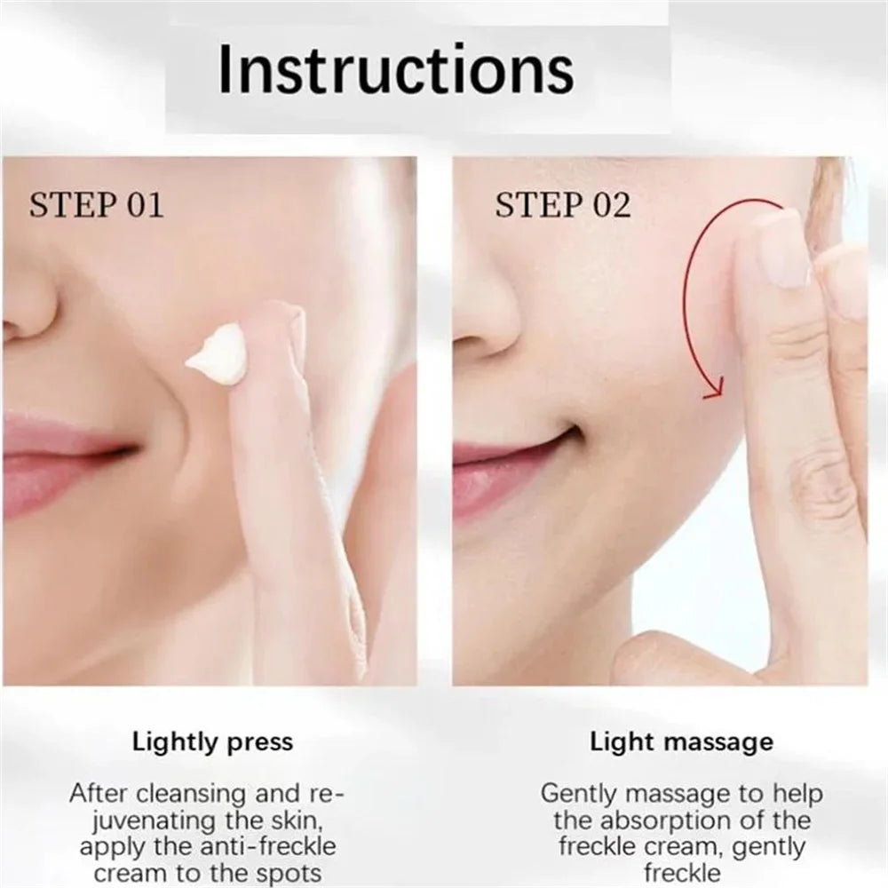 Spot-Removing Whitening Cream - Melasma & Dark Spot Treatment