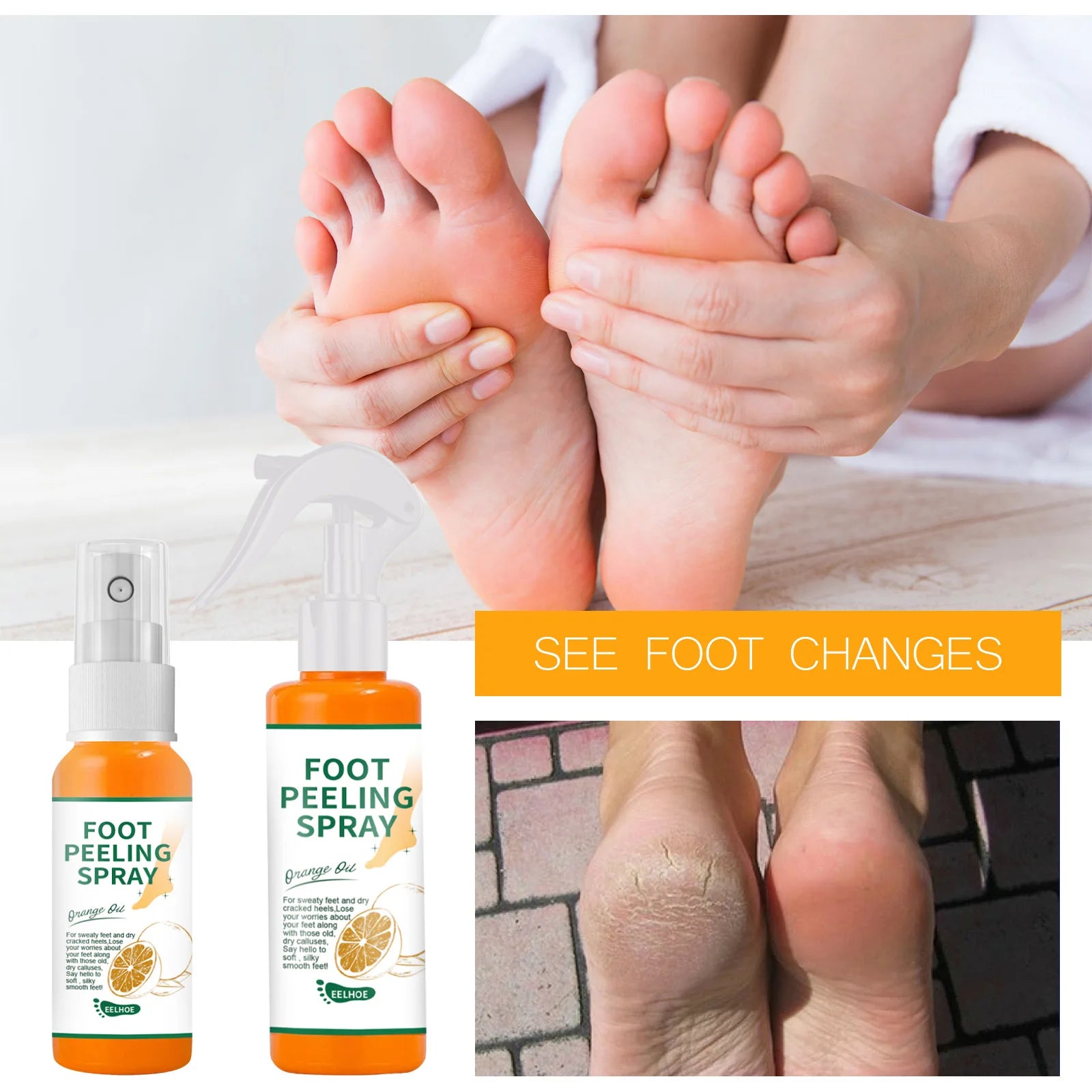 Herbal Foot Cream Spray - Anti-Crack Heel Repair & Exfoliation (100ml)