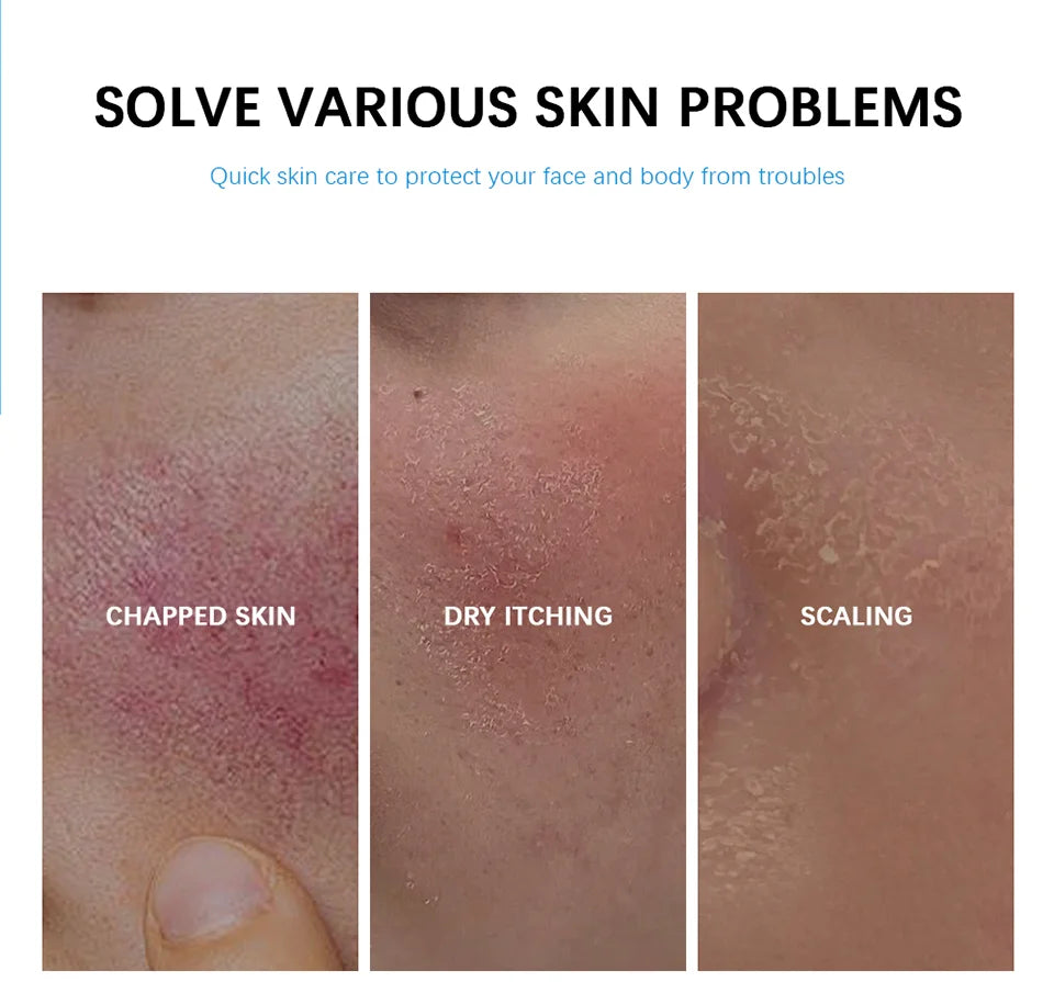 Soothing Hydrating Cream +B5 - Redness Relief & Deep Moisture