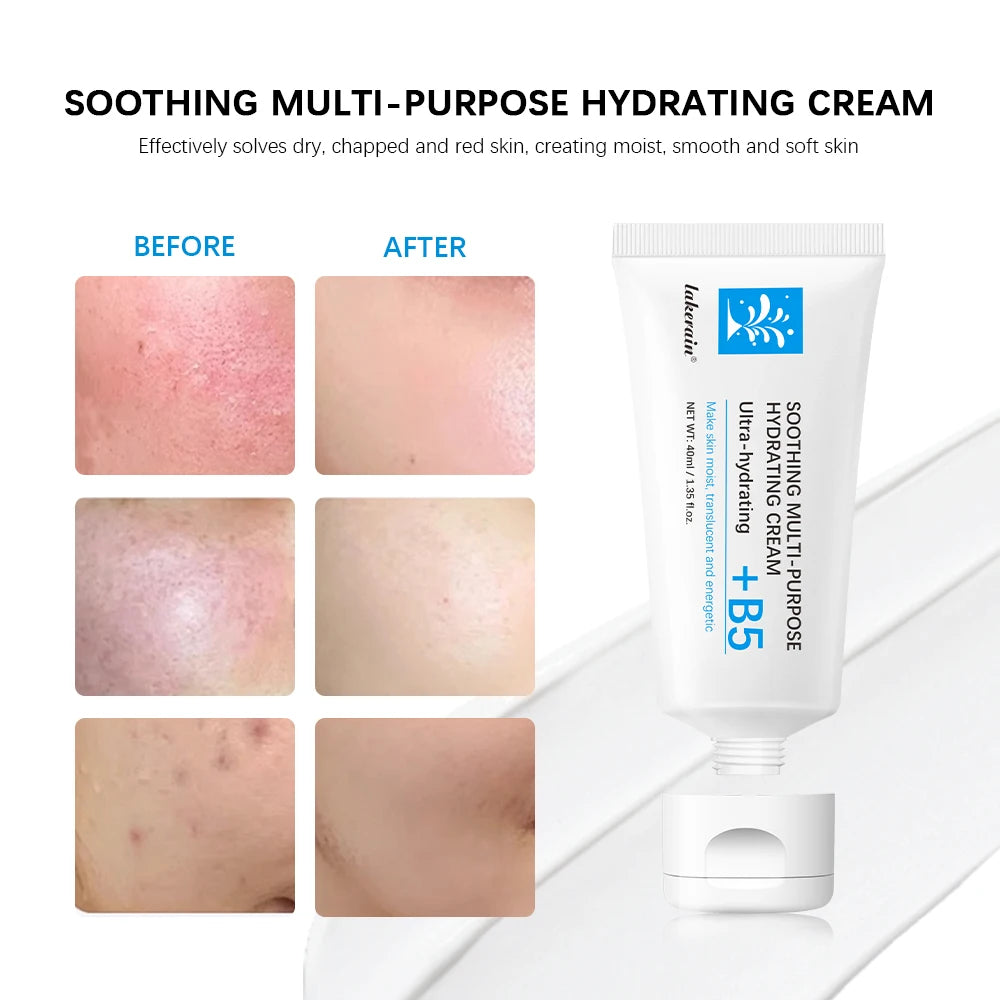 Soothing Hydrating Cream +B5 - Redness Relief & Deep Moisture