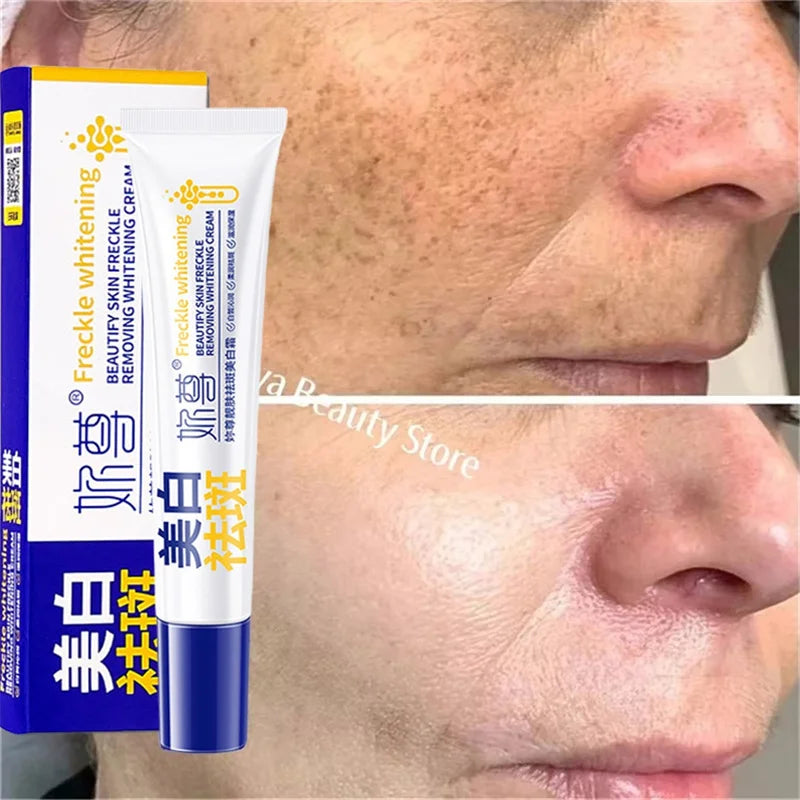 Spot-Removing Whitening Cream - Melasma & Dark Spot Treatment