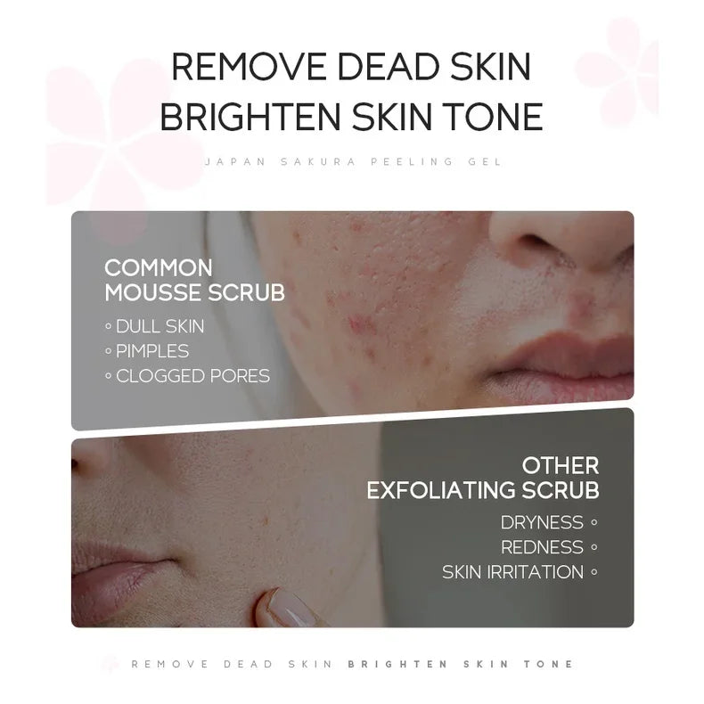 Sakura Peeling Gel - Gentle Exfoliator