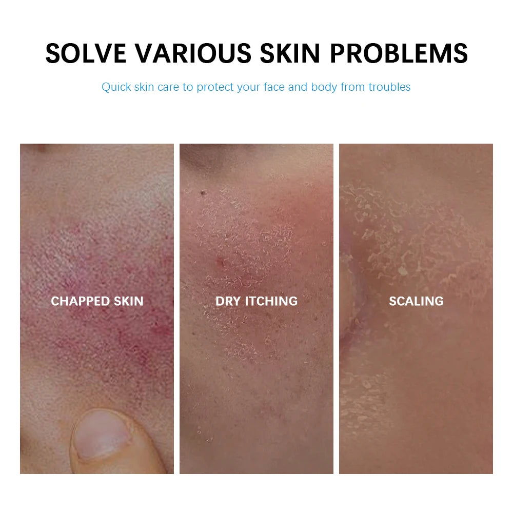 Soothing Hydrating Cream +B5 - Redness Relief & Deep Moisture