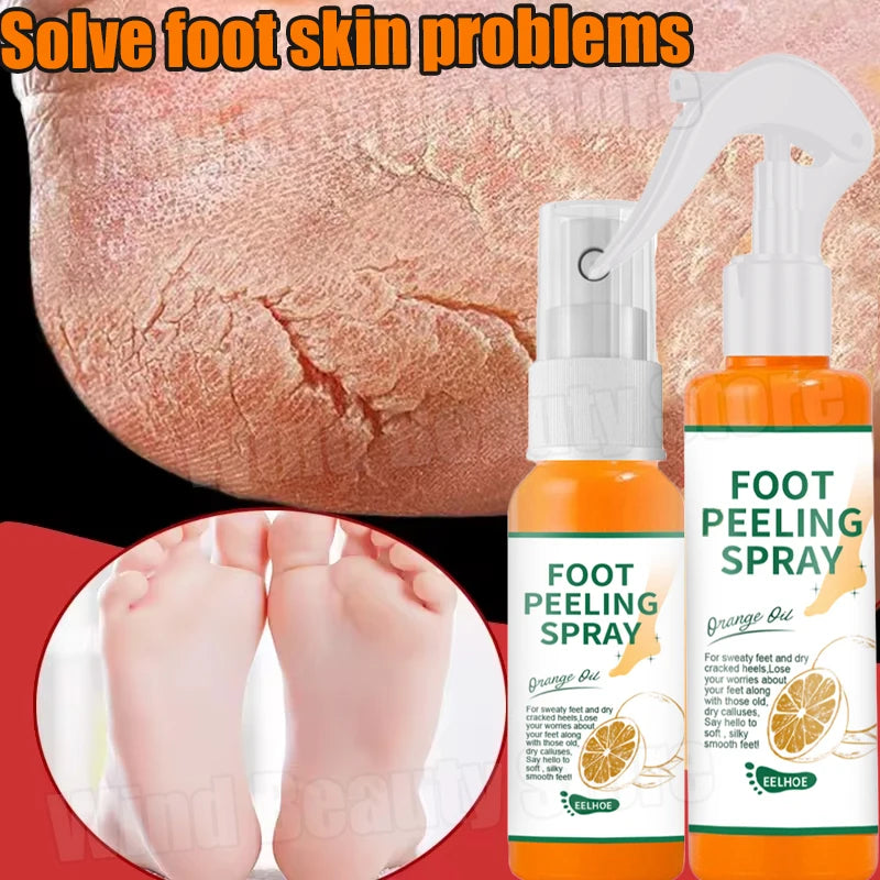 Herbal Foot Cream Spray - Anti-Crack Heel Repair & Exfoliation (100ml)