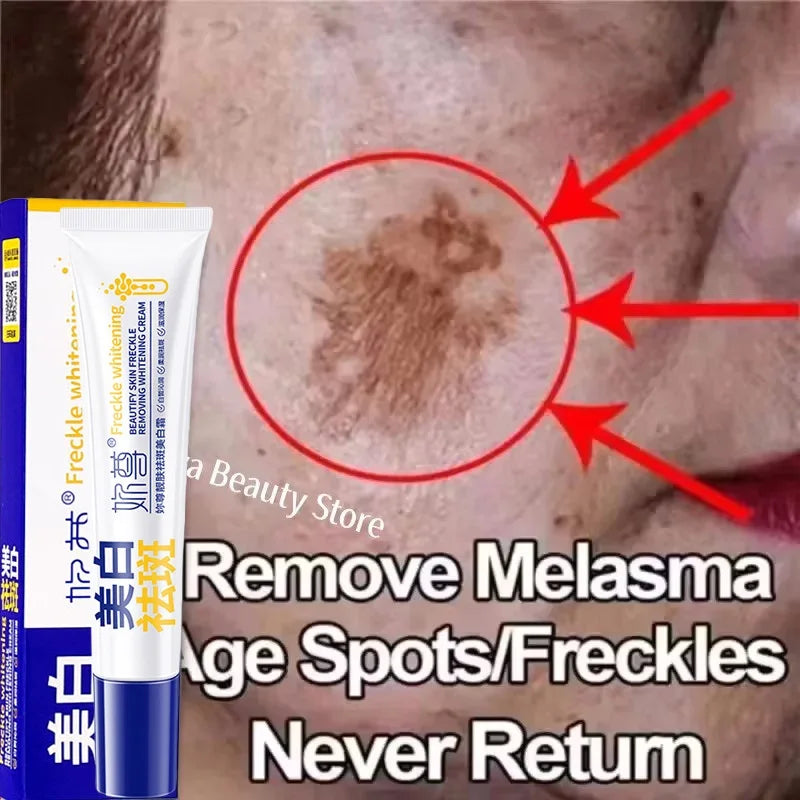 Spot-Removing Whitening Cream - Melasma & Dark Spot Treatment