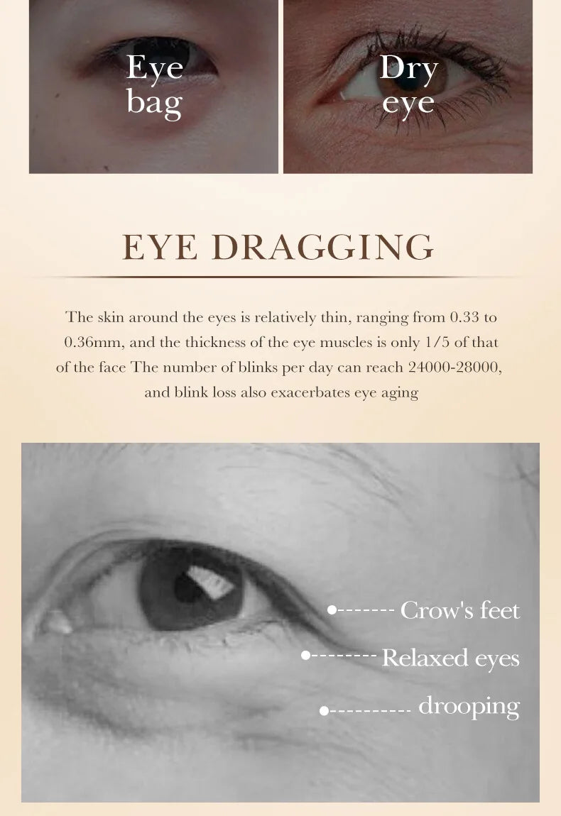 Intensive Eye Recovery Cream - Anti-Dark Circles & Wrinkle Repair