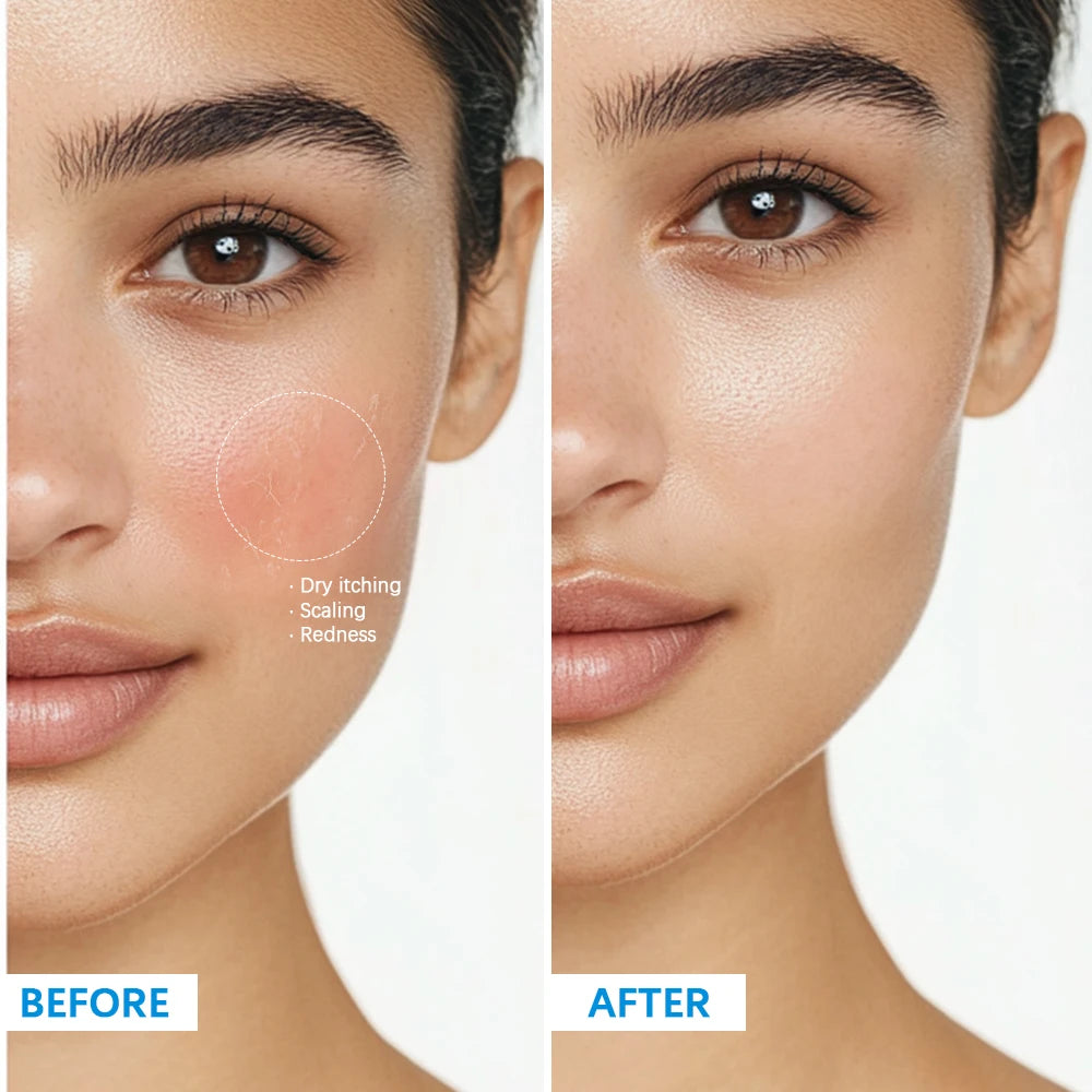 Soothing Hydrating Cream +B5 - Redness Relief & Deep Moisture