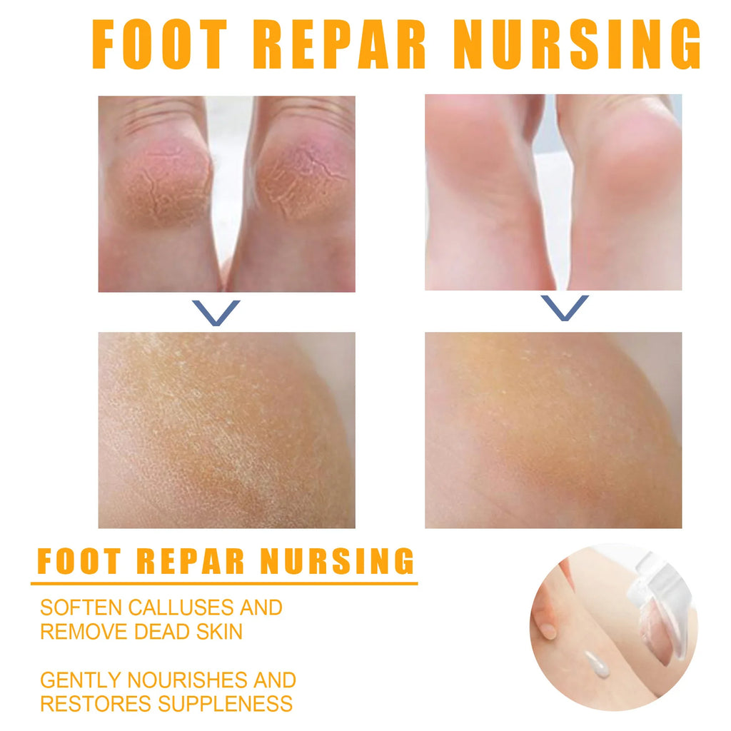 Herbal Foot Cream Spray - Anti-Crack Heel Repair & Exfoliation (100ml)