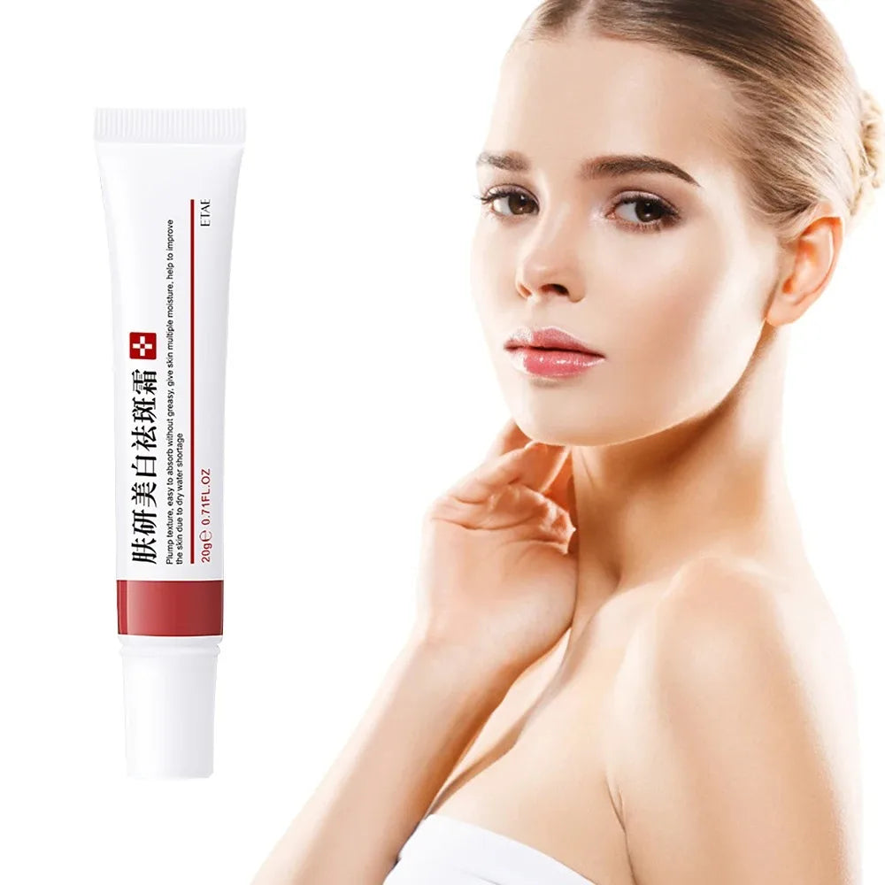 Brightening Freckle Cream - Dark Spot & Melasma Treatment