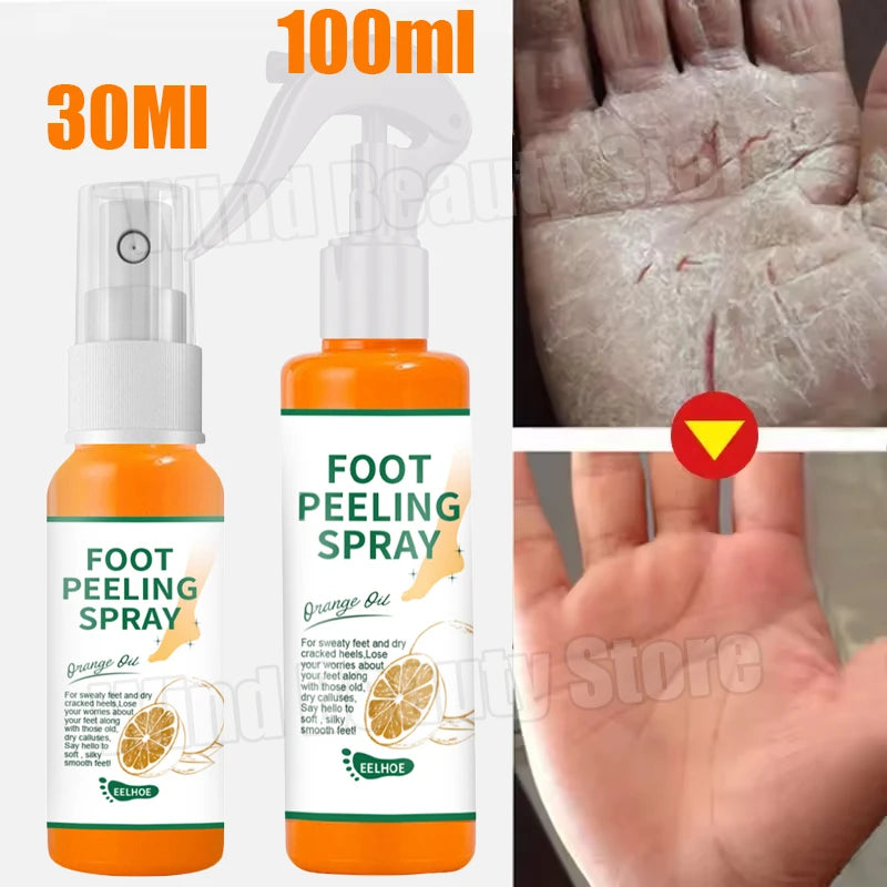 Herbal Foot Cream Spray - Anti-Crack Heel Repair & Exfoliation (100ml)